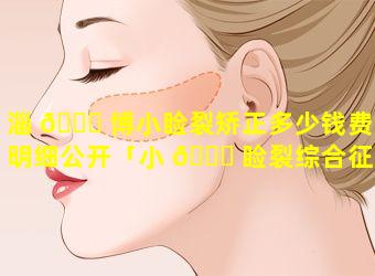 淄 🍀 博小睑裂矫正多少钱费用明细公开「小 💐 睑裂综合征手术费用」